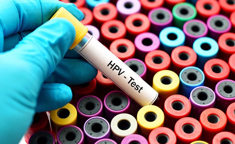 Kadın hastanesinde 2 ay boyunca HPV test kiti yokmuş