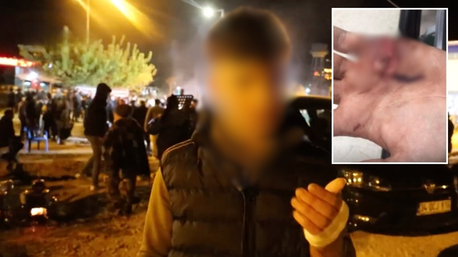Gözaltında işkence iddiası: 17 yaşındaki çocuğun eli yarıldı