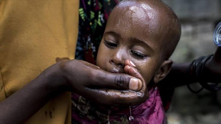 Sudan’da kolera salgını: 852 kişi hayatını kaybetti