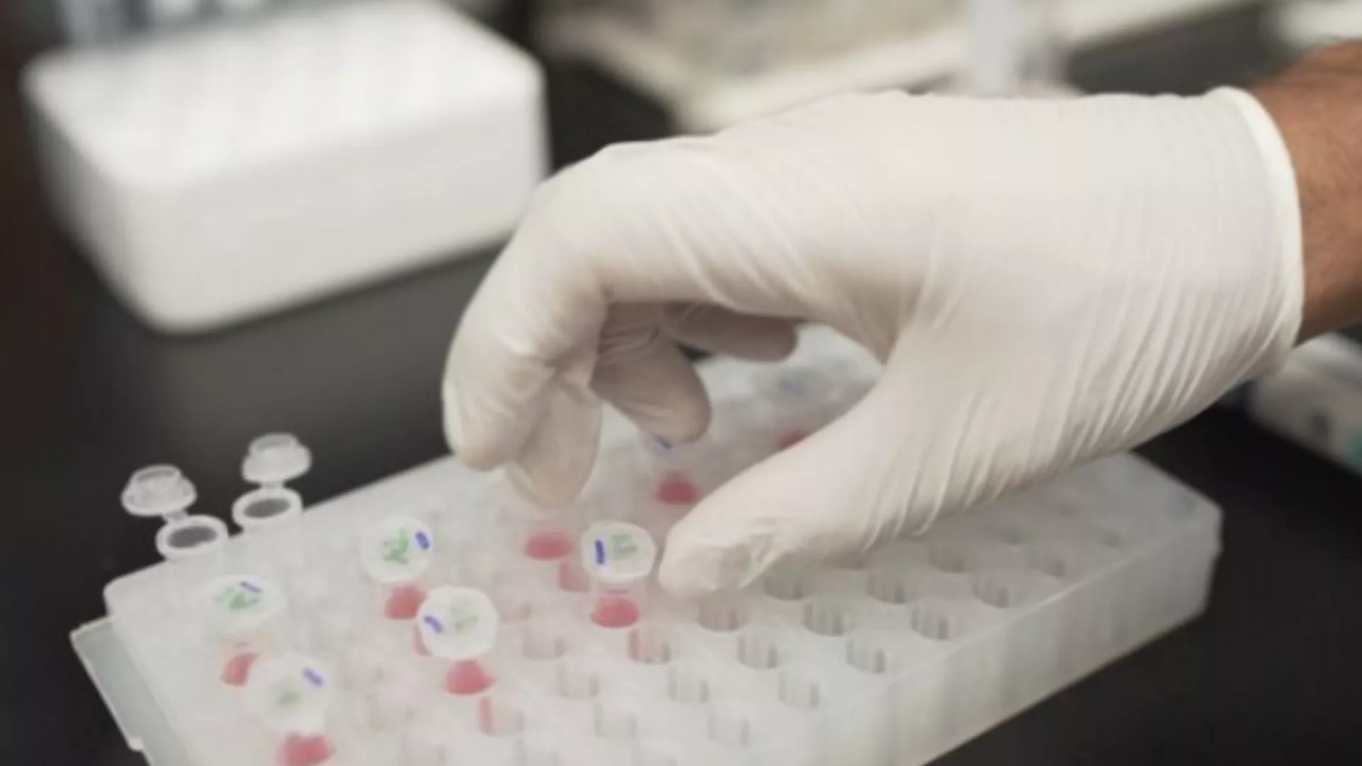 Alzheimer teşhisinde yeni kan testi geliştirildi