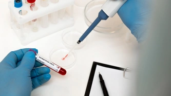 Meksika’da ilk kez bir insanda ‘H5N1’ türü kuş gribine rastlandı