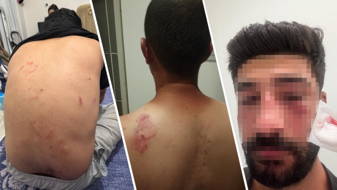 Mersin’de Kürt aileye ırkçı saldırı