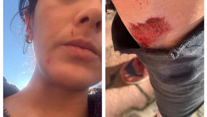 Gazeteci Ezgi Soysal: 10 kişinin saldırısına uğradım, ölebilirdim