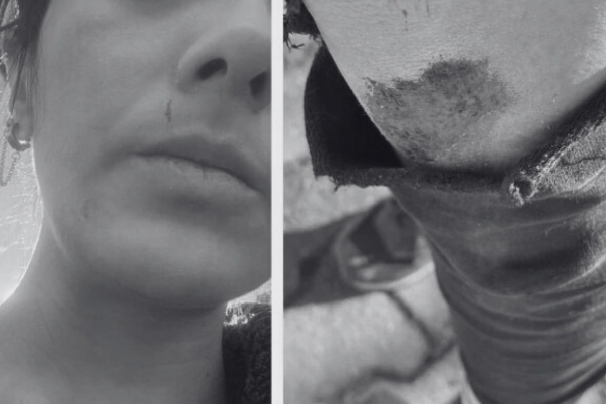 Gazeteci Ezgi Soysal: 10 kişinin saldırısına uğradım, ölebilirdim