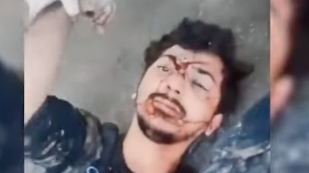 İHD ve TİHV’den açıklama: Diyar Koç’a yapılanla işkence yasağı ihlal edildi