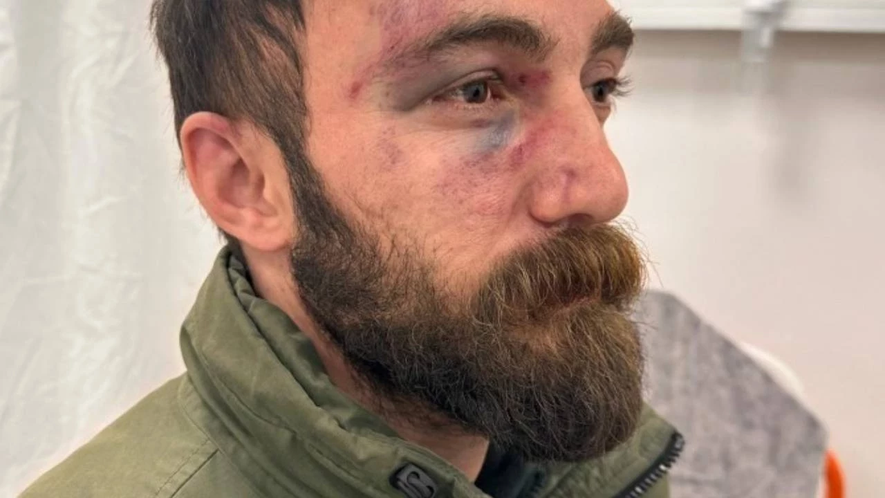 Kuzey ve Doğu Suriye protestoları: Gözaltı aracındaki darp hastanede görüntülendi