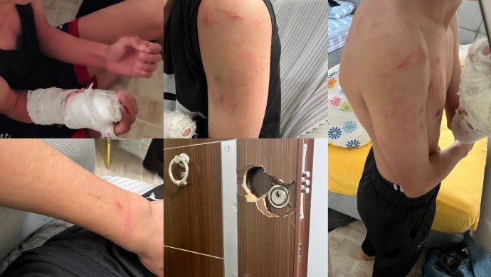 Bingöl’de yanlış eve polis baskını: 15 yaşındaki çocuğun kolu kırıldı